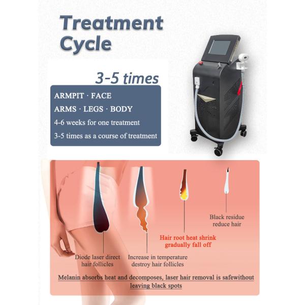 vertical professional diode laser 808nm hair removal machine / Newest Best price 808nm diode laser hair removal machine