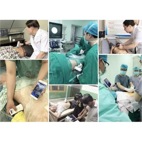 GYN Ultrasound Instruments Wireless Portable Clinical Probe Analytical Instruments Mobile Ultrasound Machine