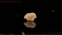 Strength Emax Ceramic Crown Dental Onlay with Excellent Stain Resistance China Dental Lab
