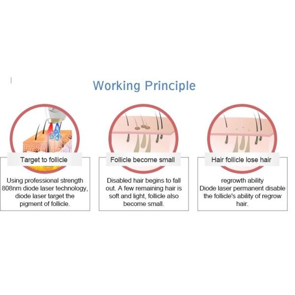 3 Wavelength Diode Laser Hair Removal Machine 755nm 808nm 1064nm Available