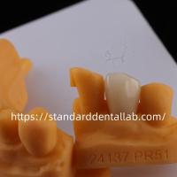 Coroas de laboratório dentário de contorno completo de alta translucidez
