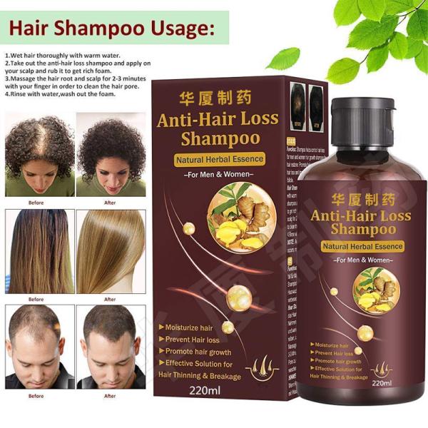 Private Label Hair Loss Shampoo Hair Thickening Shampoo Helps Stop Hair Loss