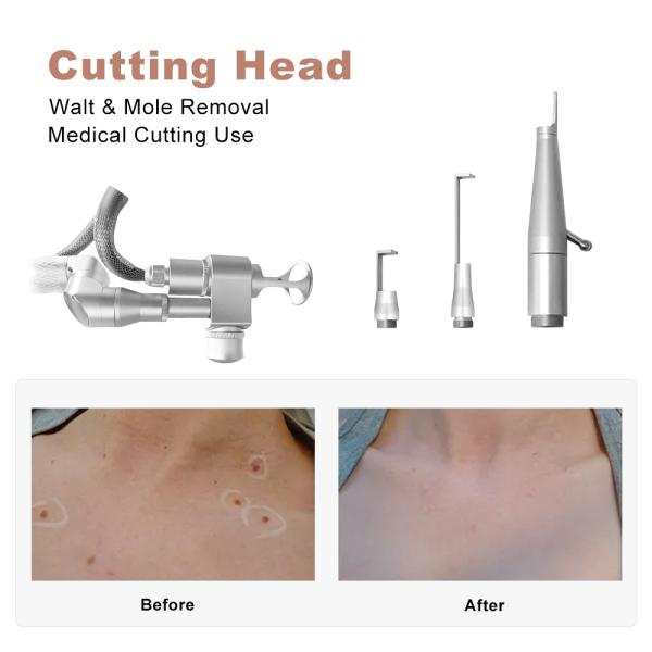 Desktop Co2 Fractional Laser Equipment Pigment Scar Removal Skin Resurfacing Machine