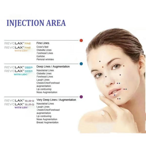 Жидкостный Hyaluronic кисловочный дермальный уход за лицом пластиковое Revolax заполнителя