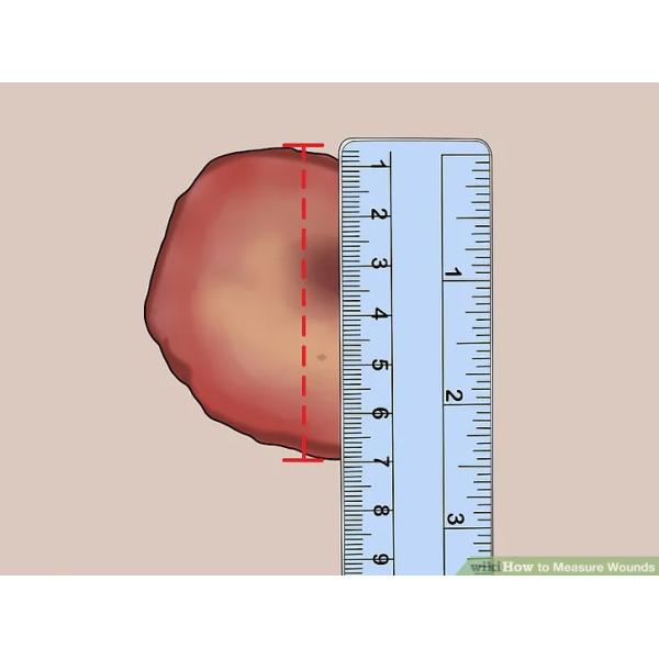 Traitement des plaies auto-adhésif Ligne médicale réglateur de mesure pour infirmières Documentation