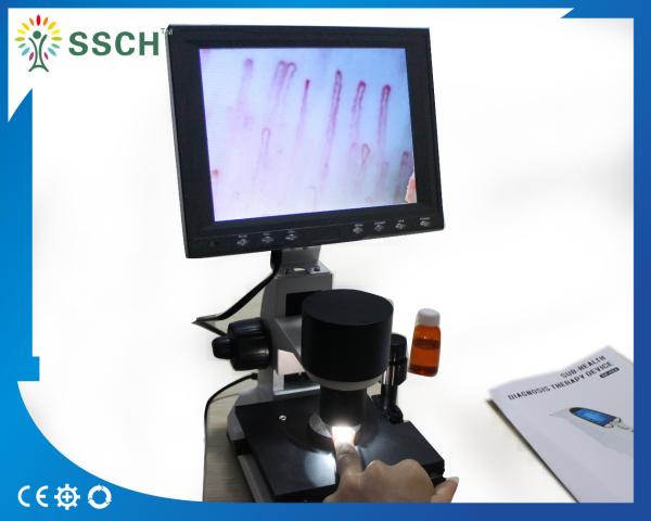 Do Microcirculation capilar preto do prego do LCD de 7 polegadas luz fria do diodo emissor de luz