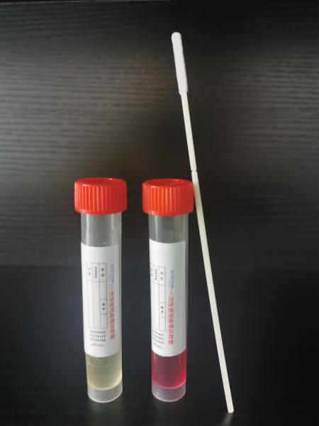 Testes da doença de pé e de boca da mão do tubo de amostra do vírus do laboratório da microbiologia