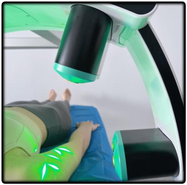 532nm Terapia de Luz Verde Laser Frio Máquina Rapida de Emagrecimento 10D Redução de Celulite Para Salão de Beleza