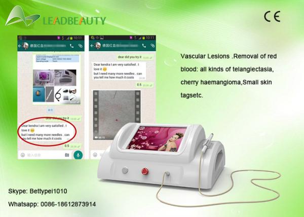 Portable High frequency 30MHZ thermal coagulation vascular spider vein removal machine