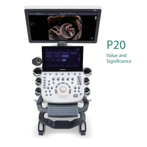Sonoscape Portable Color Doppler Ultrasound Sonoscape S22 Ultrasound Machine Sonoscape P20 Doppler Ultrasound