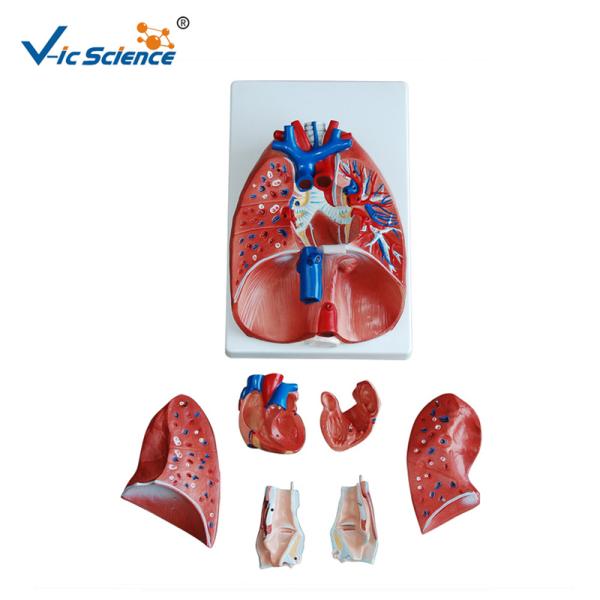 Larynx Heart And Lung 36x23x12CM Human Anatomical Model