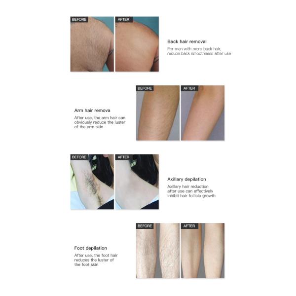 Машина удаления волос лазера диода OEM одобренная CE экран касания 10,4 дюймов