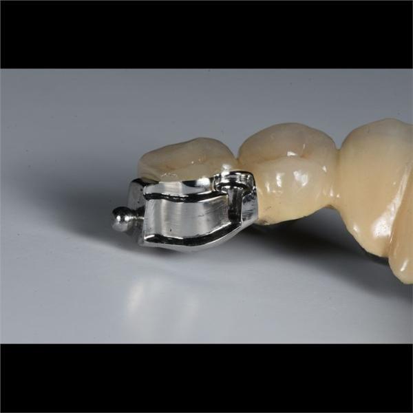 Aesthetic Partial Denture Precision Attachments Medical Grade OEM