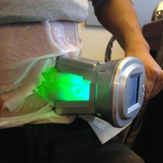 Cryotherapy/Weight Loss/Cryo Slimming Cryolipolysis Fat Freezing Machine Best Price Cryolipolysis Vacuum Therapy Machine