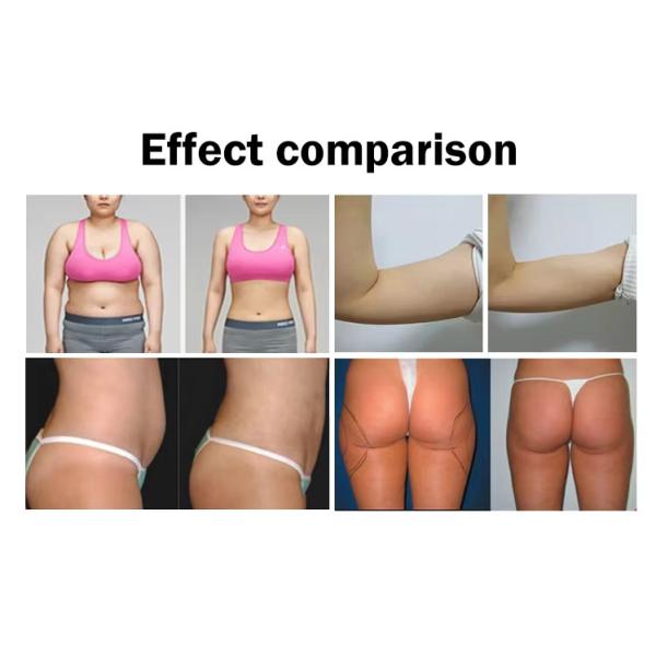 5 головы Вакуум RF Удаление морщин Скульптура тела Укрепление косметической машины