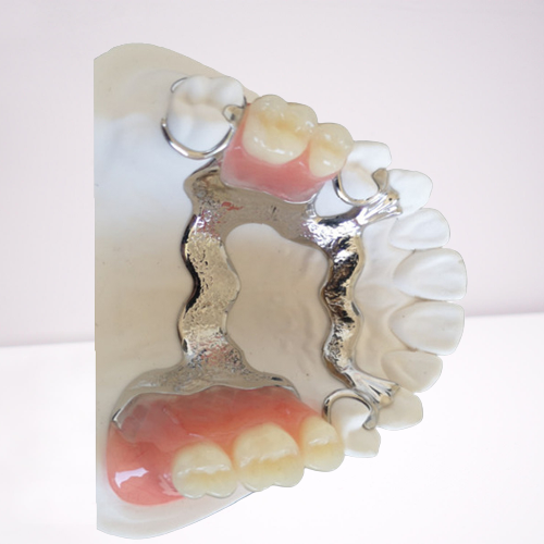 3D Printing PFM Dental Crown Customized High Biological Intermiscibility