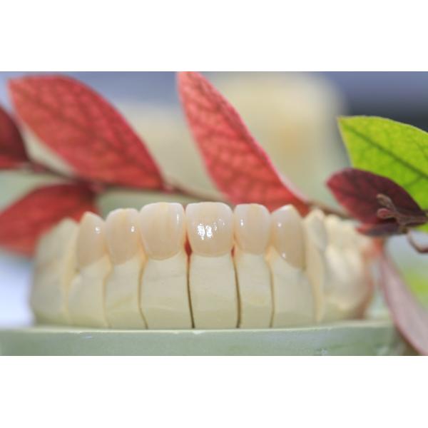 Dental Lab Fixed Prosthetics Layered Zirconia Dental Crown For Front Teeth