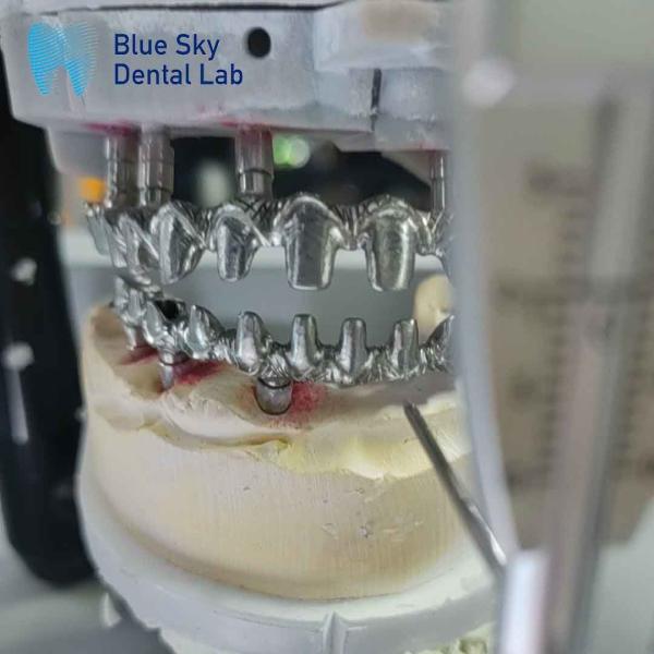 Puits à implants en titane pur à cadre métallique