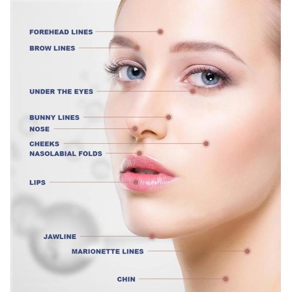 24mg/ml Hyaluronic Acid Dermal Filler For Natural Facial Enhancement