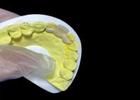 Coroa de cerâmica dentária de aparência natural HPP ponte cerâmica ligada fácil limpeza