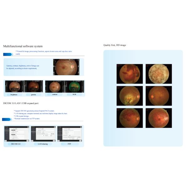 Автоматическая машина фотографии камеры Fundus Chinrest регулируя зрачок ища выравнивание