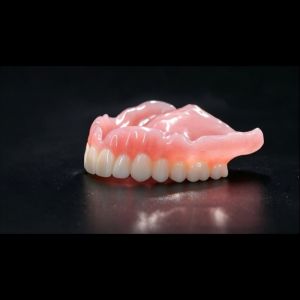 Removable Dentures