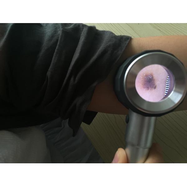 Lupa del analizador de la piel de Viedo Dermatoscope del hospital en piel y pelo