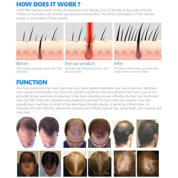 Zohonice Laser Helmet Hair Growth Hair Care Therapy Massage