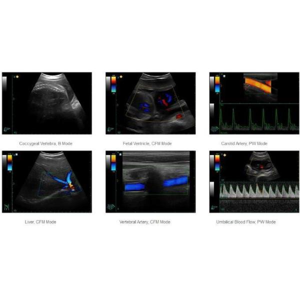 Portable Ultrasound Unit Portable Ultrasound Scanner With 3D Optional And 5.5Kgs Weight