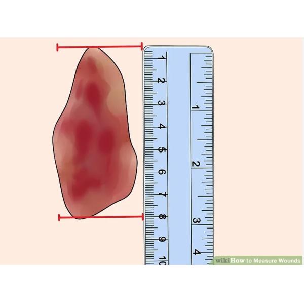 Traitement des plaies auto-adhésif Ligne médicale réglateur de mesure pour infirmières Documentation