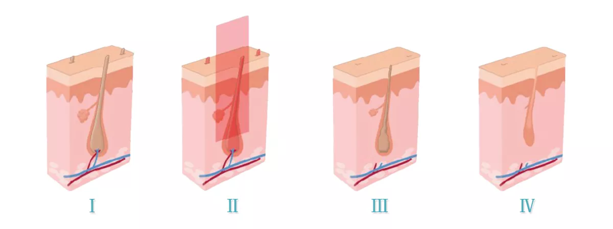Эффективный тип 3 в 1 E-свете выбирает машина подмолаживания кожи Shr Ipl удаления волос лазера Shr Ipl