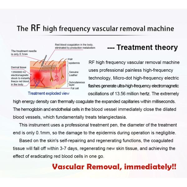 35w Vascular Removal RF Beauty Equipment For Facial Lifting