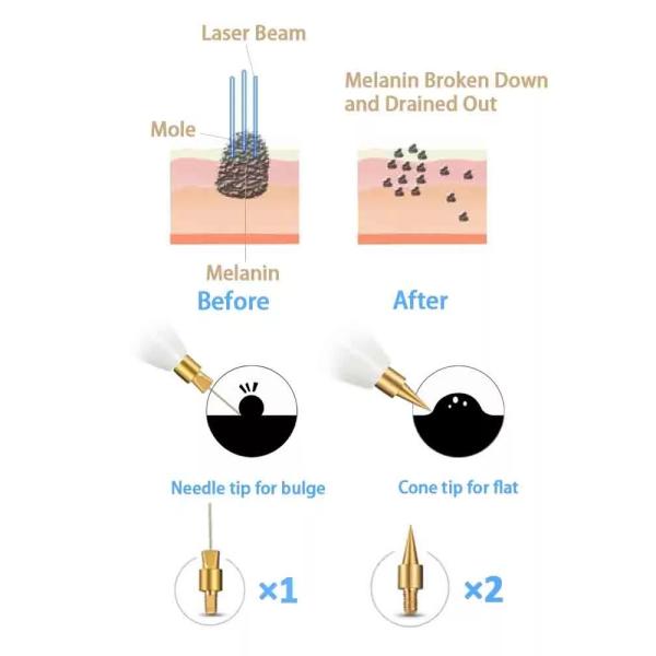 110V-240V Rated Voltage Tattoo Removal Rechargeable Mini Mole Laser Pen for Beauty Care