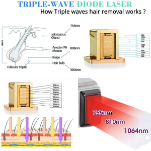 Triple waves diode laser hair removal