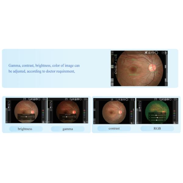 Не Mydriatic автоматизированное оборудование камеры 305 Nm Fundus ретинальное отображая