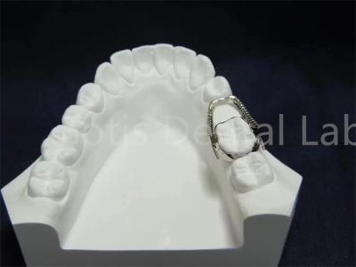 Adjustable Retainer Expander Convenient Orthodontic Solution Easy Maintenance