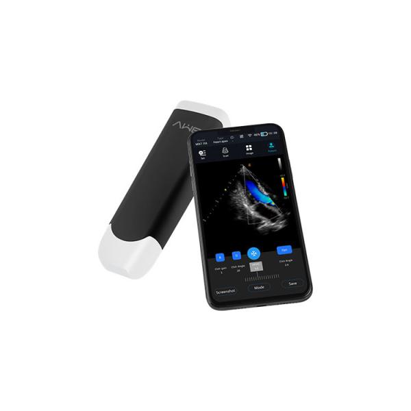 Portable Handheld Wireless Probe Type Ultrasound Scanner 2mhz