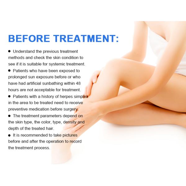 машина лазера удаления волос диода IPL 480nm 640nm медицинская