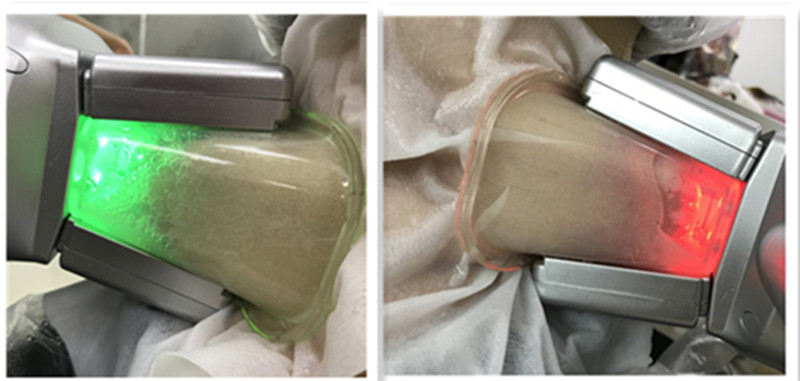 Машина Cryolipolysis компактного размера жирная замерзая отсутствие хирургического взреза
