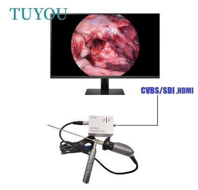 Full HD Electric Portable ENT Endoscope Medical Camera For Laptop Computer