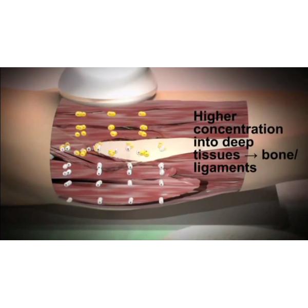 Профессиональное вакуумное всасывание RF обезболивающее устройство Форма тела Удаление целлюлита