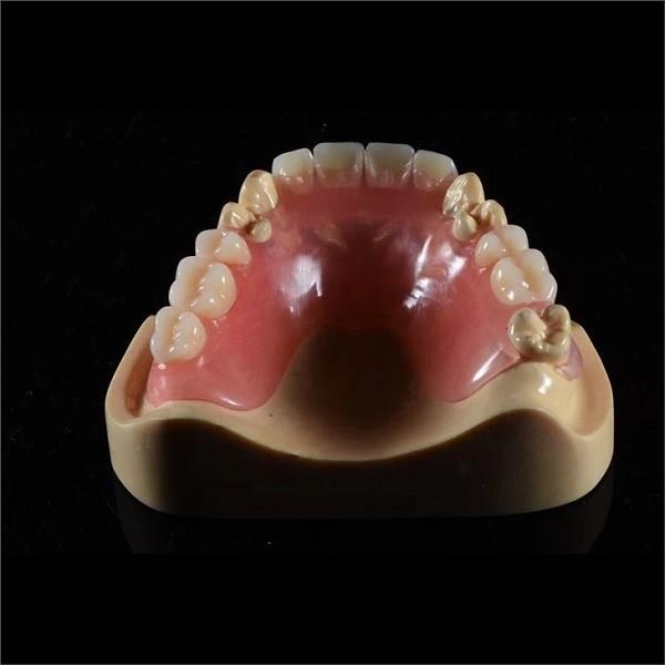 Lightweight Flexible Valplast Partial Denture For Single Tooth