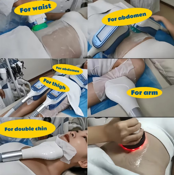 9 In1 Weight Loss Cool Tech Body Slimming Fat Freezing 360Cryolipolysis Machine