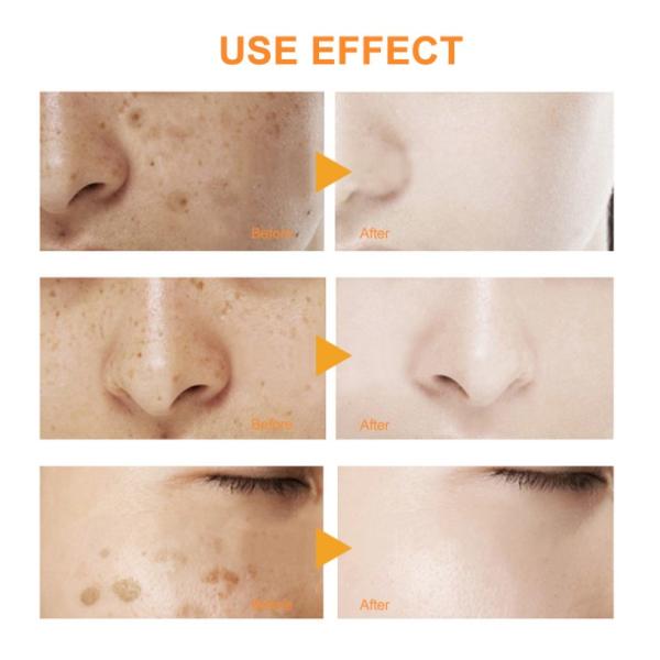 100 мл лицевой тонер для ухода за кожей макияжа, увлажняющий осветляющий тонер куркумы