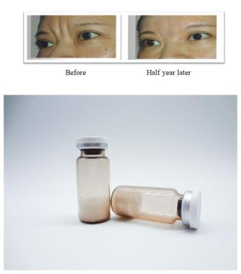 Injectable PLLA Poly-L-Lactic Acid Dermal Filler Remove Facial Wrinkles Stimulate Collagen Regeneration