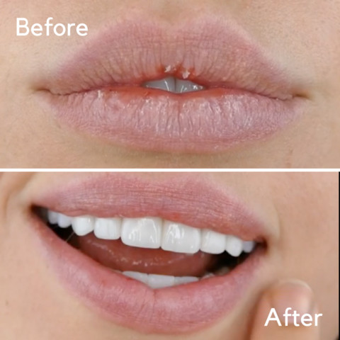 Private Label Strawberry Lip Scrub , ODM Organic Lip Scrub For Lip Care