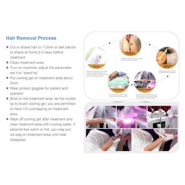 755 808nm Alexandrite Laser Beauty Machine / Diode Laser Hair Removal Machine