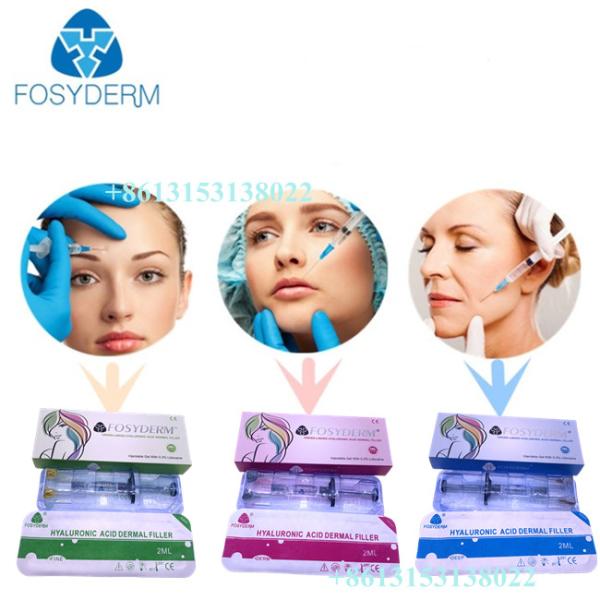Впрыска 24mg/ml HA дермального заполнителя Fosyderm Hyaluronic кисловочная для CE губ