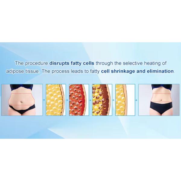 Бесконтактная площадь тела Снижение жировых отложений Скульптура тела Устройства для похудения для домашнего использования и салона красоты