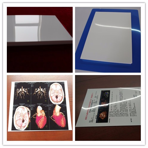 13X17'' White 180 Microns PET X Ray Film Sheets Transparency Film For Inkjet Printers